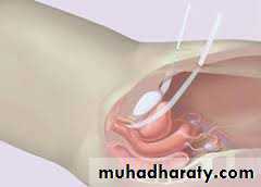 Urology