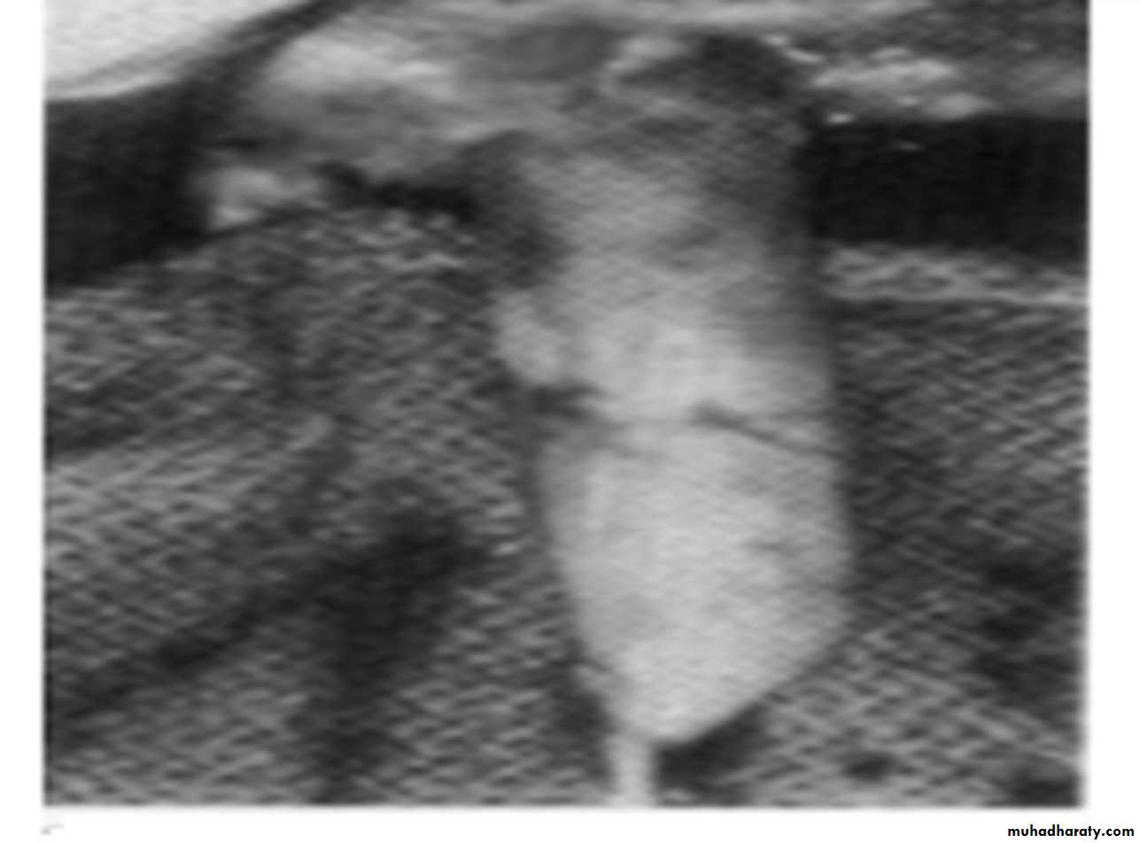 Urology