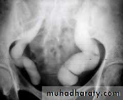 Urology