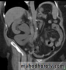 Urology