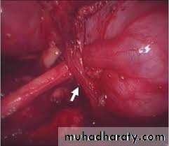 Urology