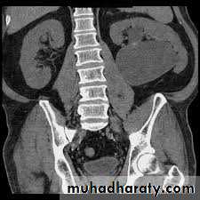 Urology