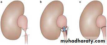 Urology
