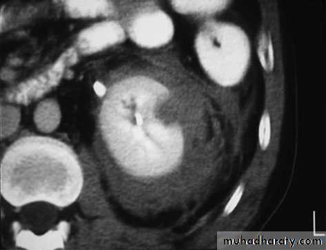 Urology