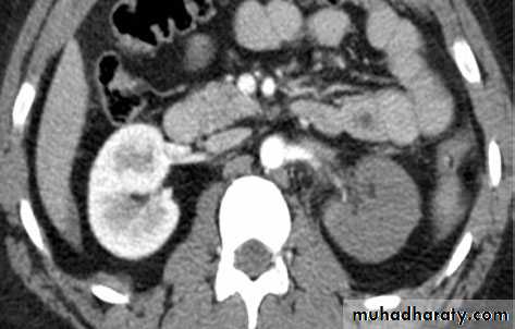 Urology