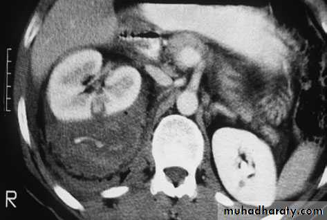 Urology