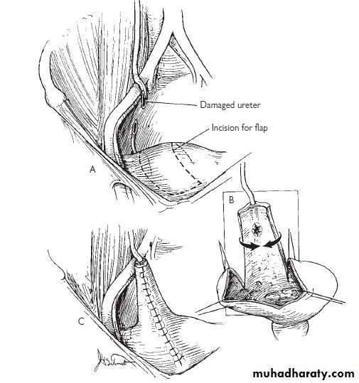 Urology