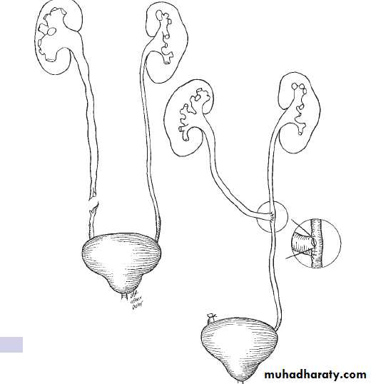 Urology