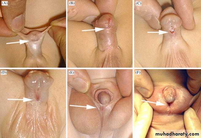 Urology