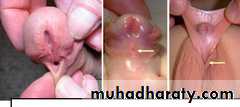 Urology