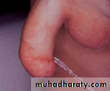 Urology
