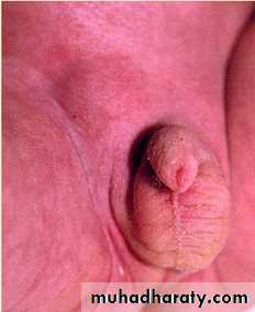 Urology