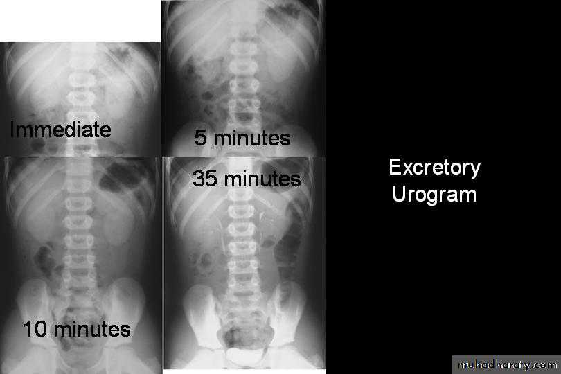Urology