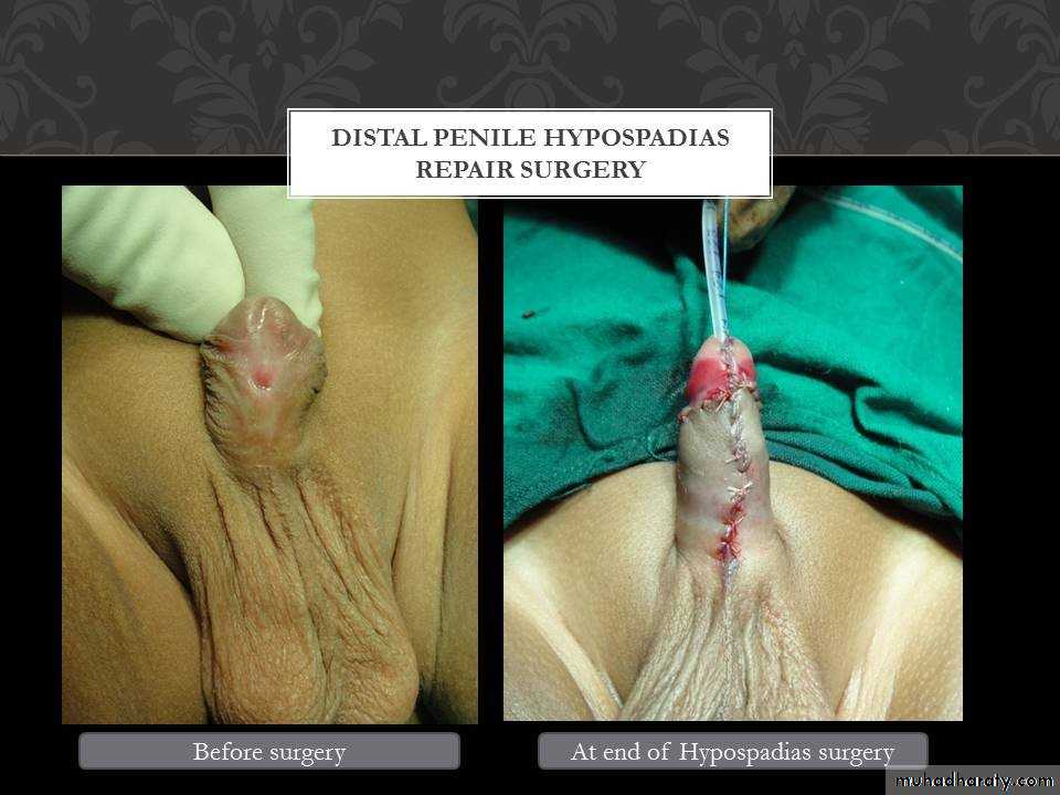 Urology