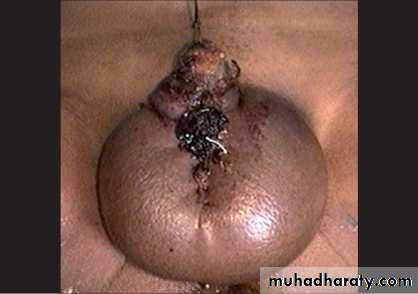 Urology