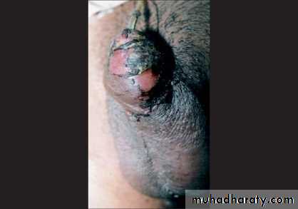 Urology