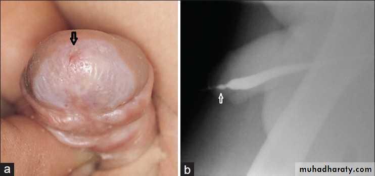 Urology
