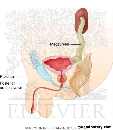 Urology