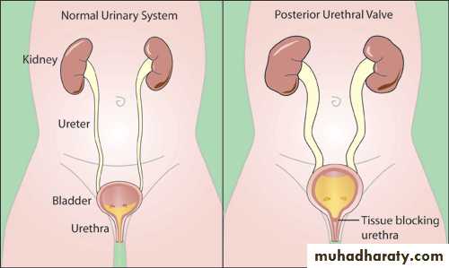Urology
