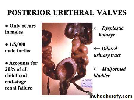 Urology