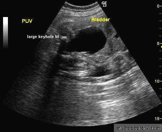 Urology