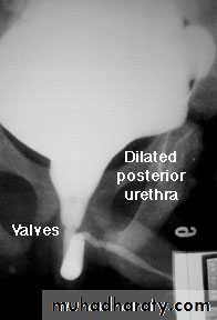 Urology