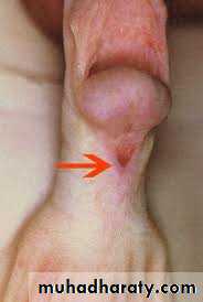 Urology