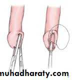 Urology