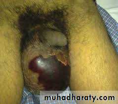 Urology