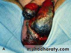 Urology