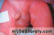 Urology