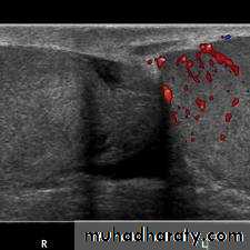 Urology