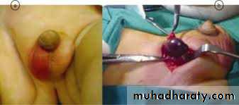 Urology