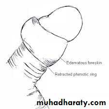 Urology