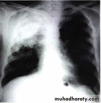 Respiratory