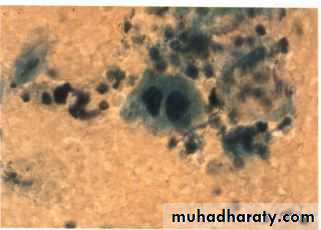 Respiratory
