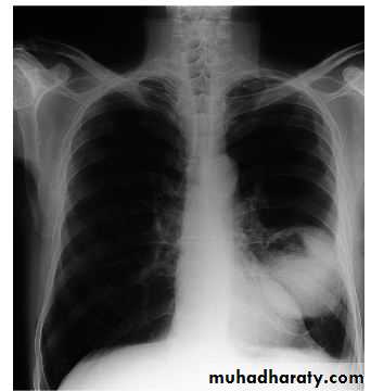 Respiratory