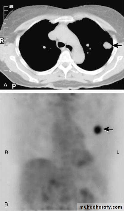 Respiratory