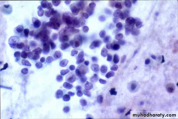 Respiratory