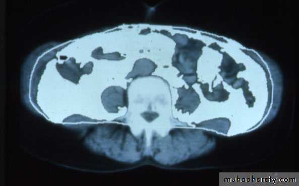 Endocrine