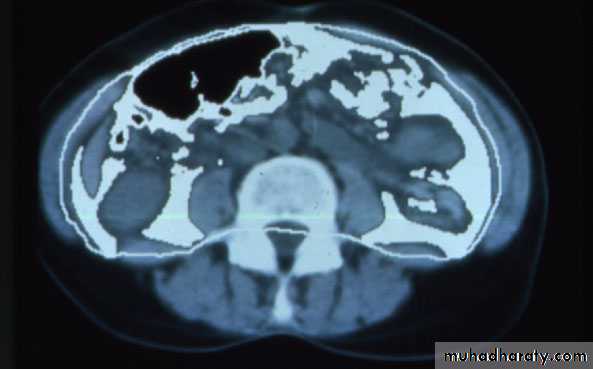 Endocrine