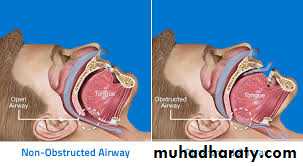 Respiratory