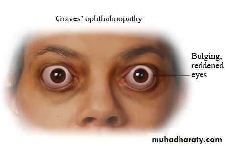 Endocrine
