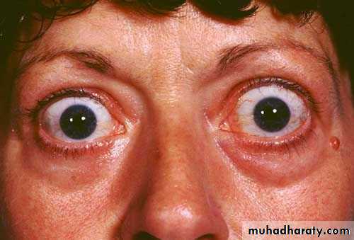 Endocrine