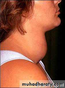 Endocrine