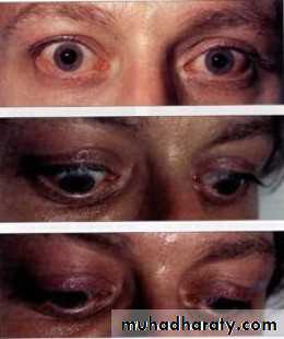 Endocrine
