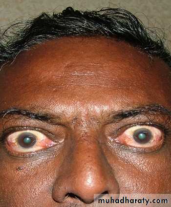 Endocrine