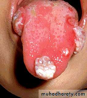 Hematopathology