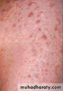 Hematopathology