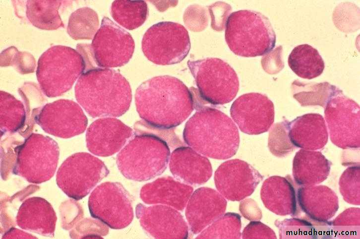 Hematopathology